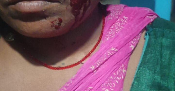 लकड़बग्घे के हमले से महिला घायल । एक पखवाड़े के अंदर तीसरी घटना से ग्रामीण भयभीत ।