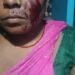 लकड़बग्घे के हमले से महिला घायल । एक पखवाड़े के अंदर तीसरी घटना से ग्रामीण भयभीत ।
