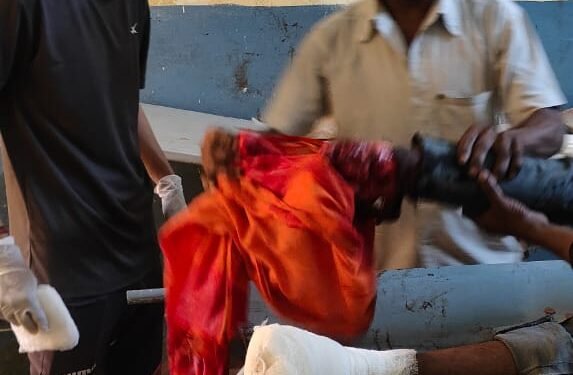 रेलवे ट्रैक पार करते वक्त ट्रेन की चपेट में आया युवकयुवक का दोनों पैर कटा, रेफर।