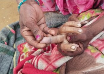 दिव्यांग महिला को सर्प दंश से मौत।