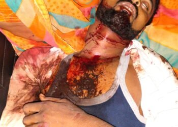 कार चला रहे युवक की गाड़ी रोककर जानलेवा हमारा,हालत नाजुक।