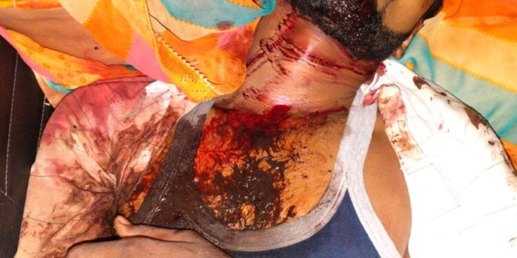 कार चला रहे युवक की गाड़ी रोककर जानलेवा हमारा,हालत नाजुक।