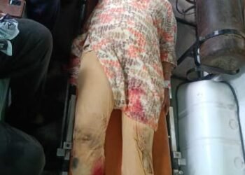 शिक्षिका की सड़क यात्रा में हादसा: स्कूल से घर जा रही शिक्षिका घायल।