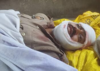 संदिग्ध परिस्थितियों में पीएसी जवान ने खुद को मारी गोली। इलाज के दौरान मौत।