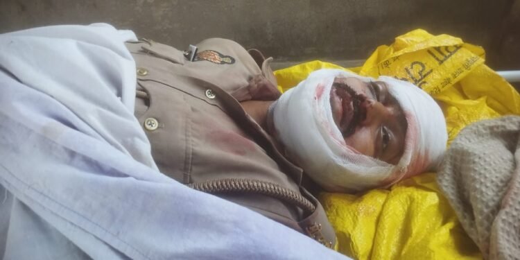 संदिग्ध परिस्थितियों में पीएसी जवान ने खुद को मारी गोली। इलाज के दौरान मौत।