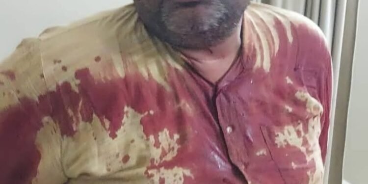 अधिवक्ता के साथ मार पीट करने वाले पुलिस अधिकारी को बर्खास्त कर कठोर करवाई करे सरकार–राकेश शरण मिश्र।