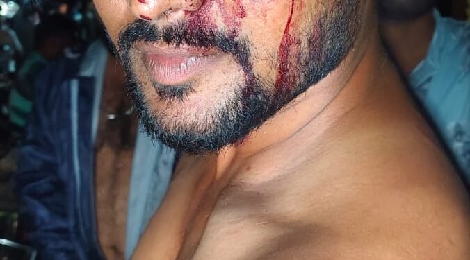 सलैयाडिह में दुर्गा पूजा समिति अध्यक्ष पर जानलेवा हमला, दो आरोपी गिरफ्तार, अन्य फरार।।