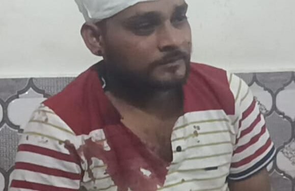 चखना विवाद में युवक पर जानलेवा हमला।